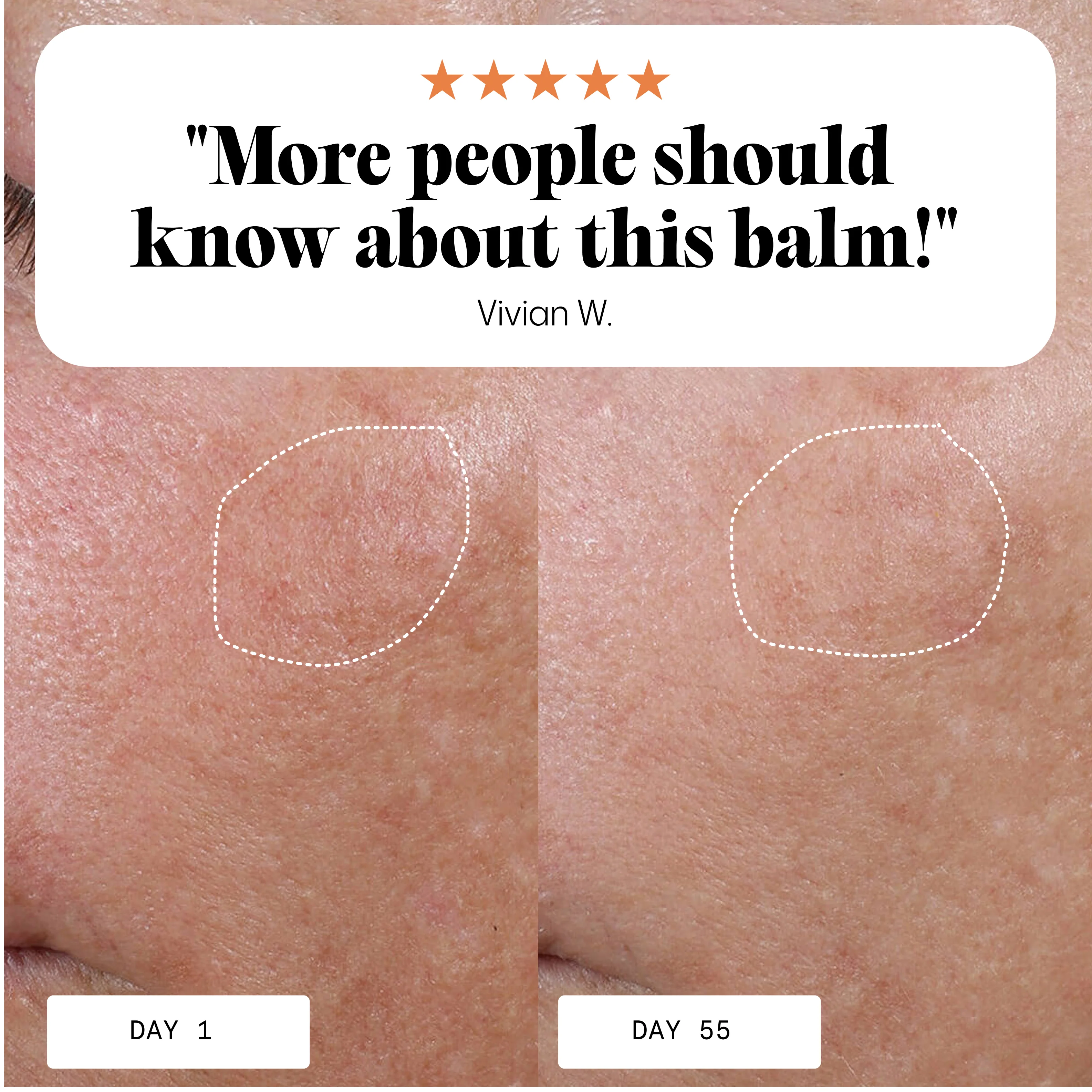 Anti-Age & Insane Glow Day Balm - Image 4