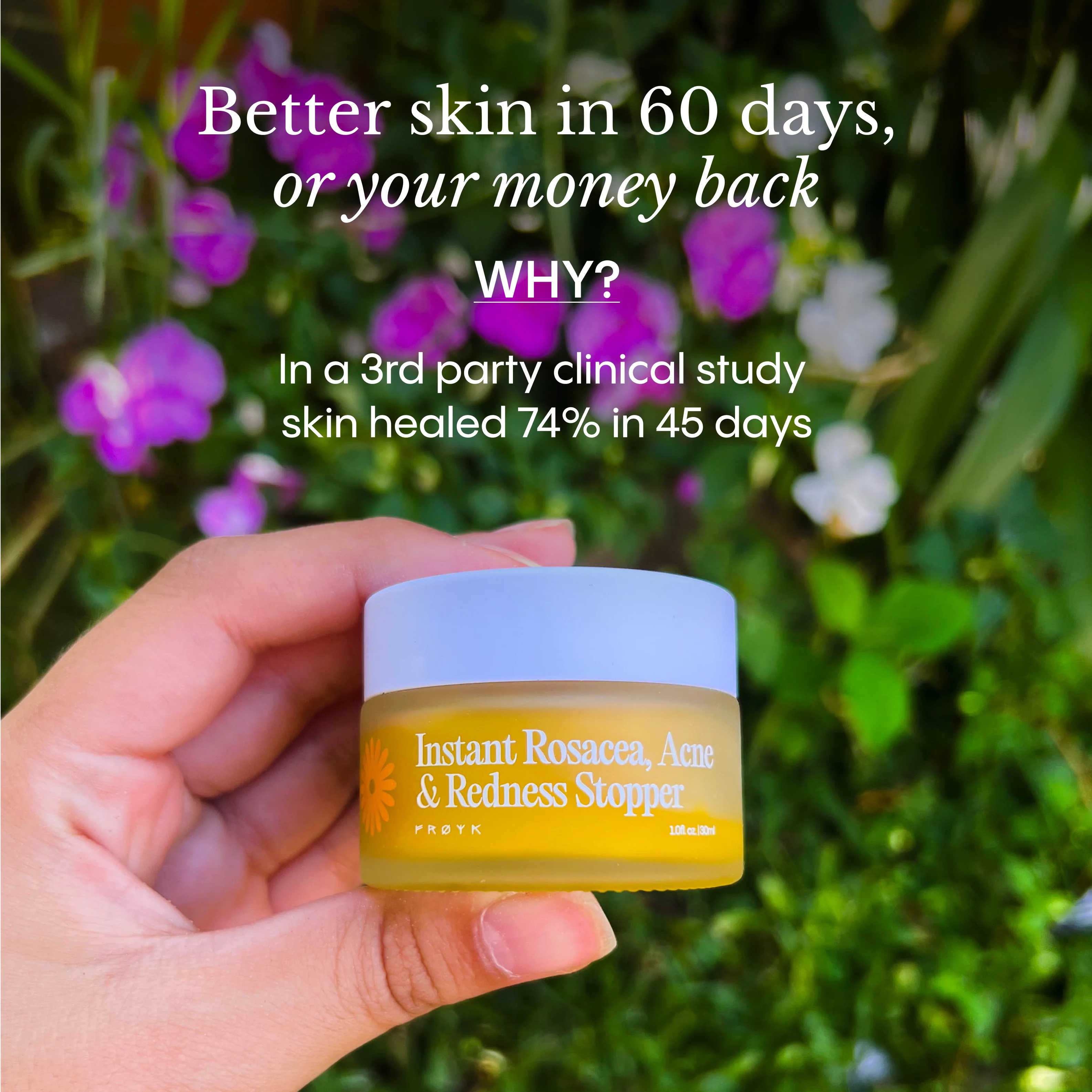 Instant Rosacea, Acne & Redness Stopper - Image 9